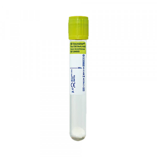 4955-vacutainer-10ml-urin-mit-stabilisierung.jpg